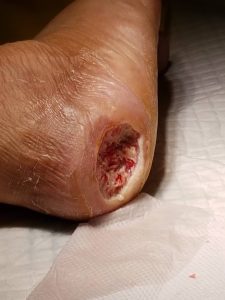 testimoni CMX kencing manis