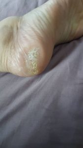 testimoni CMX kencing manis