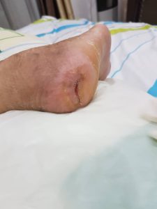 testimoni CMX kencing manis